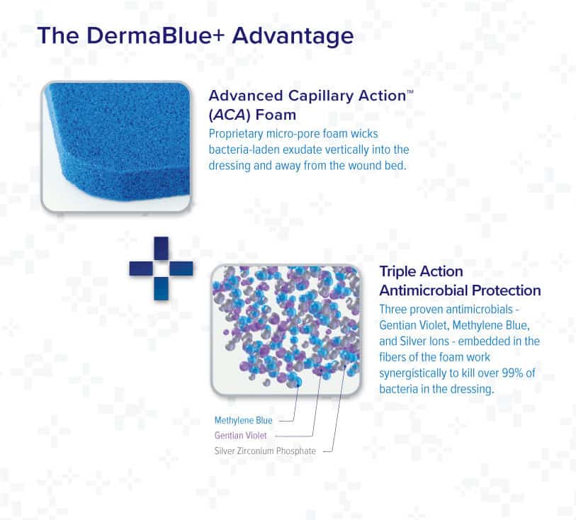blue foam wound dressing Gentell Blue Foam Dressing