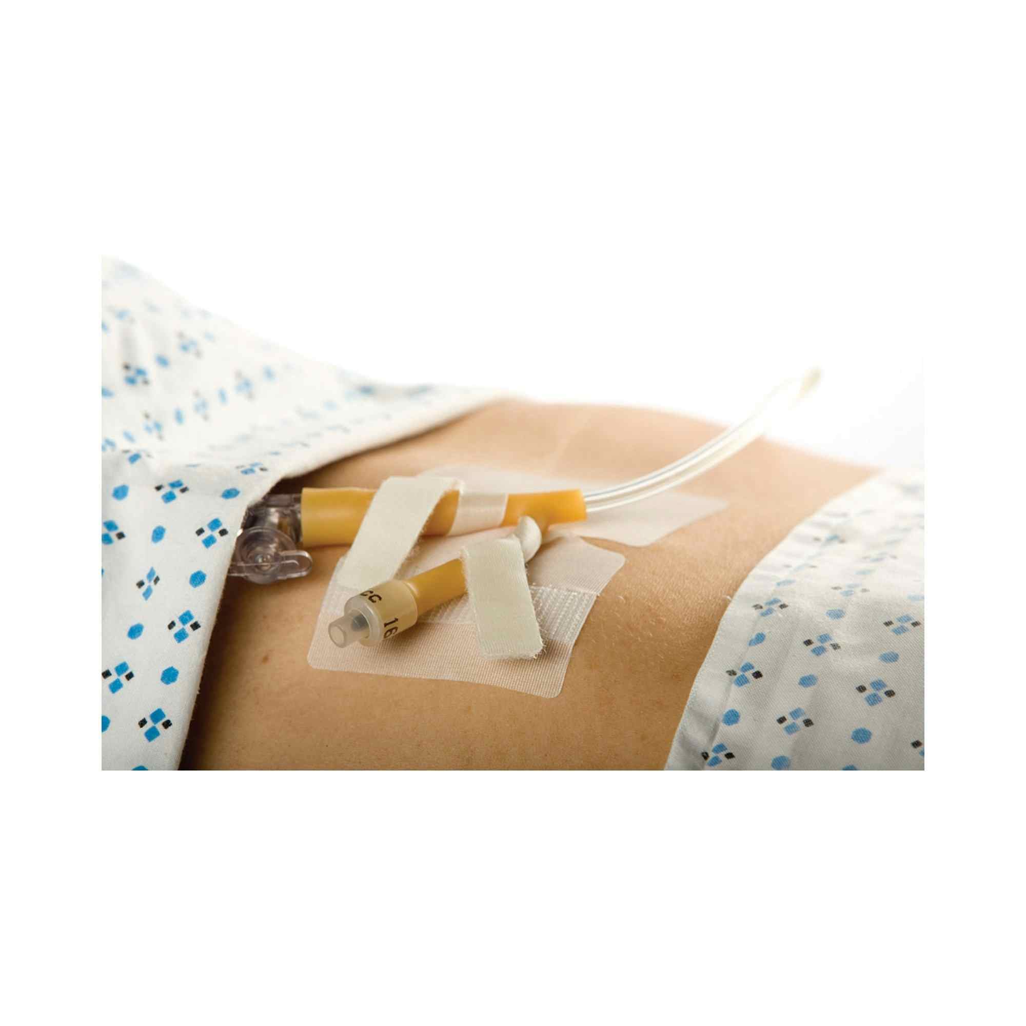 Cath-Secure Dual Tab Catheter Holder, 5445-4, 1 Each