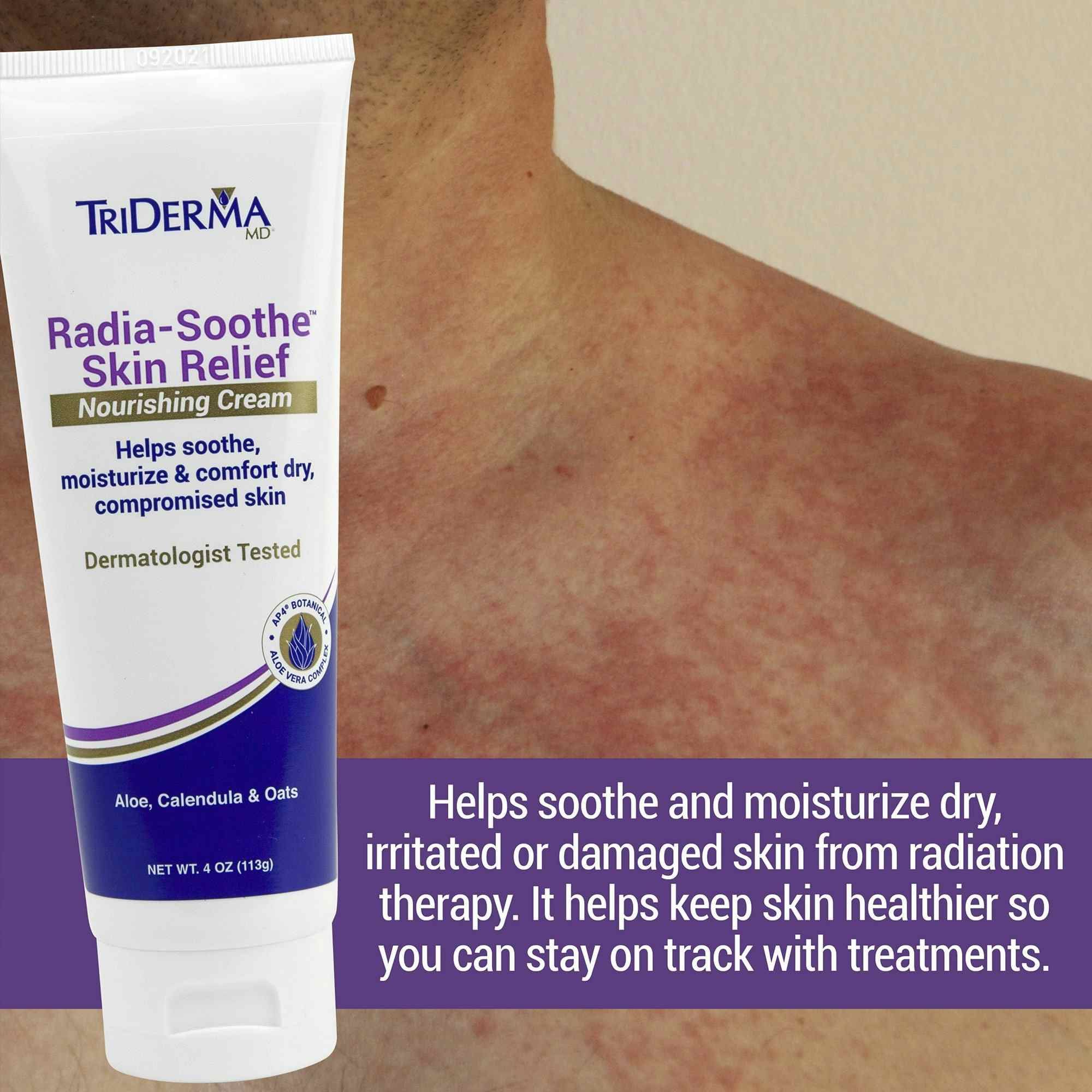 TriDerma Radiation Skin Relief Soothing and Healing Cream, 4 oz.