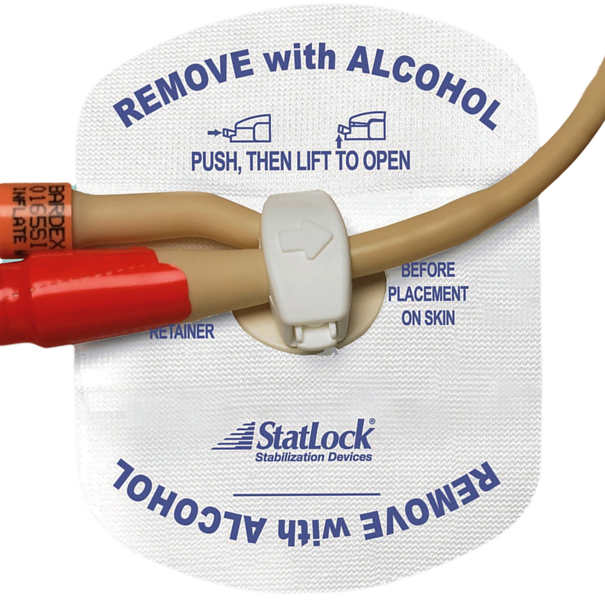 StatLock Stabilization Device for Adult Latex and Silicone Catheters