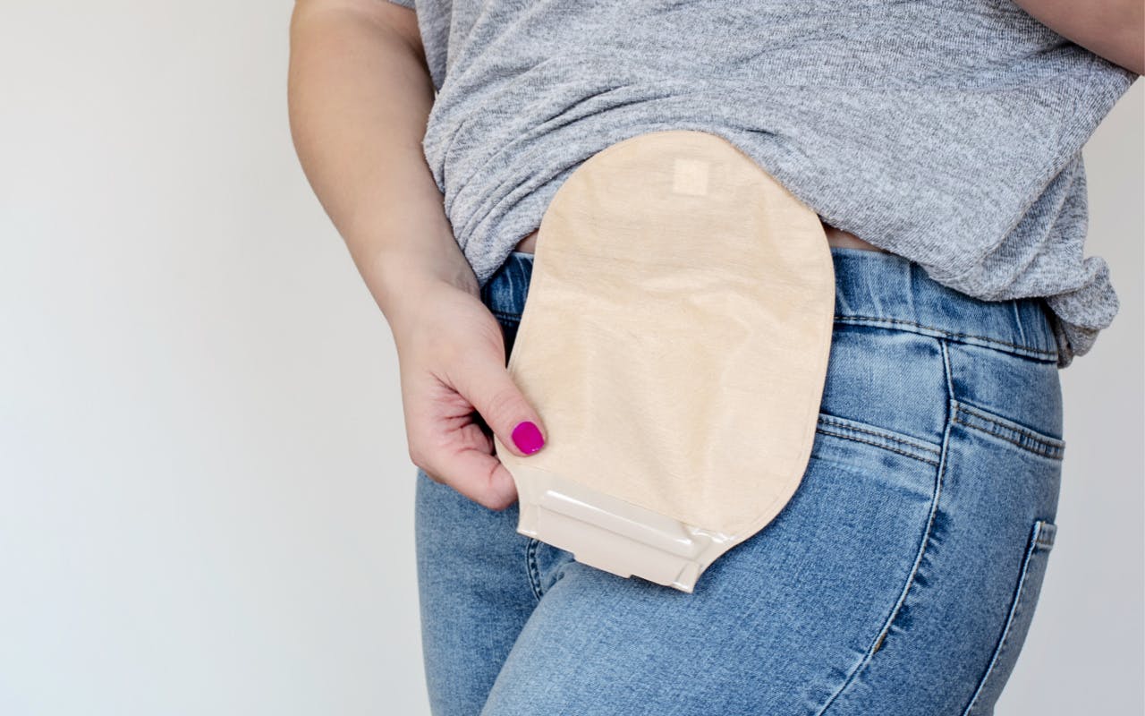 A Beginner's Guide to Ostomy Systems