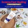 TriDerma MD Eczema Fast Healing Face & Body Cream, 6 oz